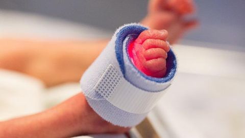 Gut Viruses May Warn of Impending Deadly Disease in Premature Infants