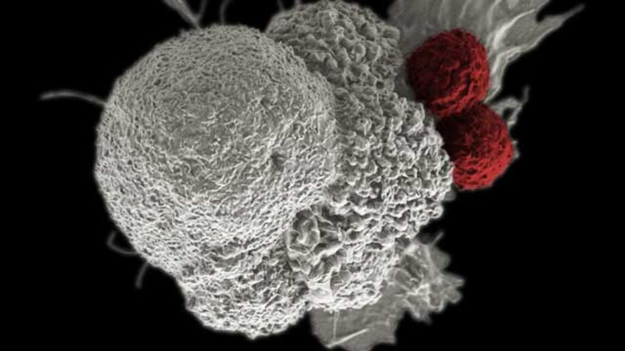 Inhibiting Protein in the Tongue Might Stall Tumor Growth
