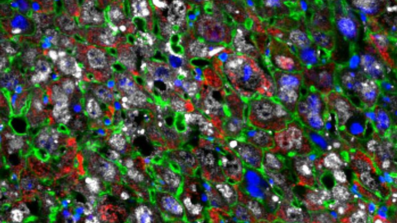 Cellular Regeneration Therapy Restores Damaged Liver Tissue Faster Than Ever