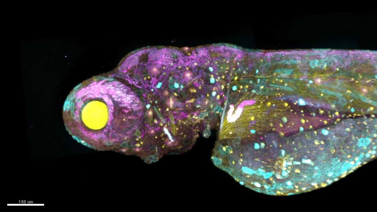 Digital Evolution: How Computer Science and AI Are Driving Microscopy Innovation and Advancing Life Sciences