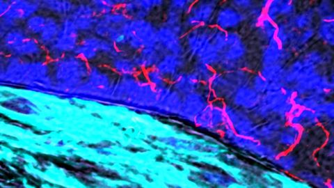 Diseased Blood Vessels May Talk to the Brain in Atherosclerosis