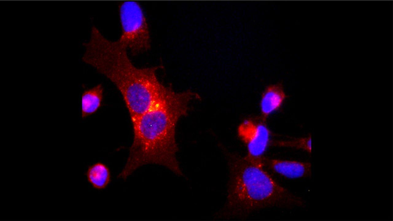 Pathway Discovered That Drives Genomic Changes in Rare Childhood Cancer