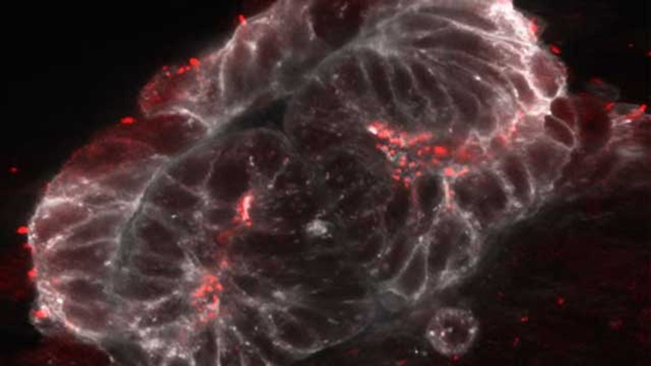 Cilia-Free Stem Cells Offer New Path To Study Rare Diseases