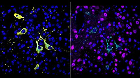 New Method Reveals How and Where Drugs Hit Their Targets