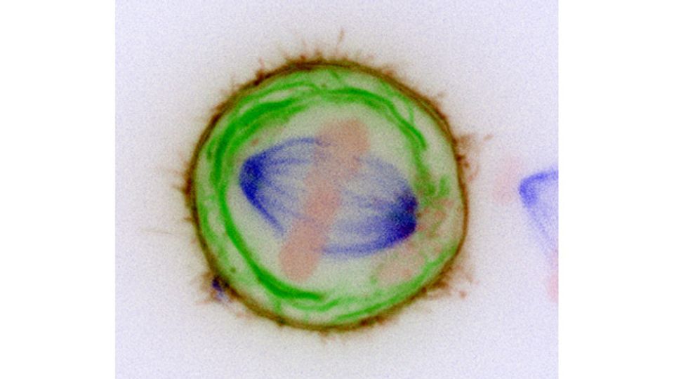 Team Identifies Cause of Cancer by Performing Cell "Surgery" content piece image