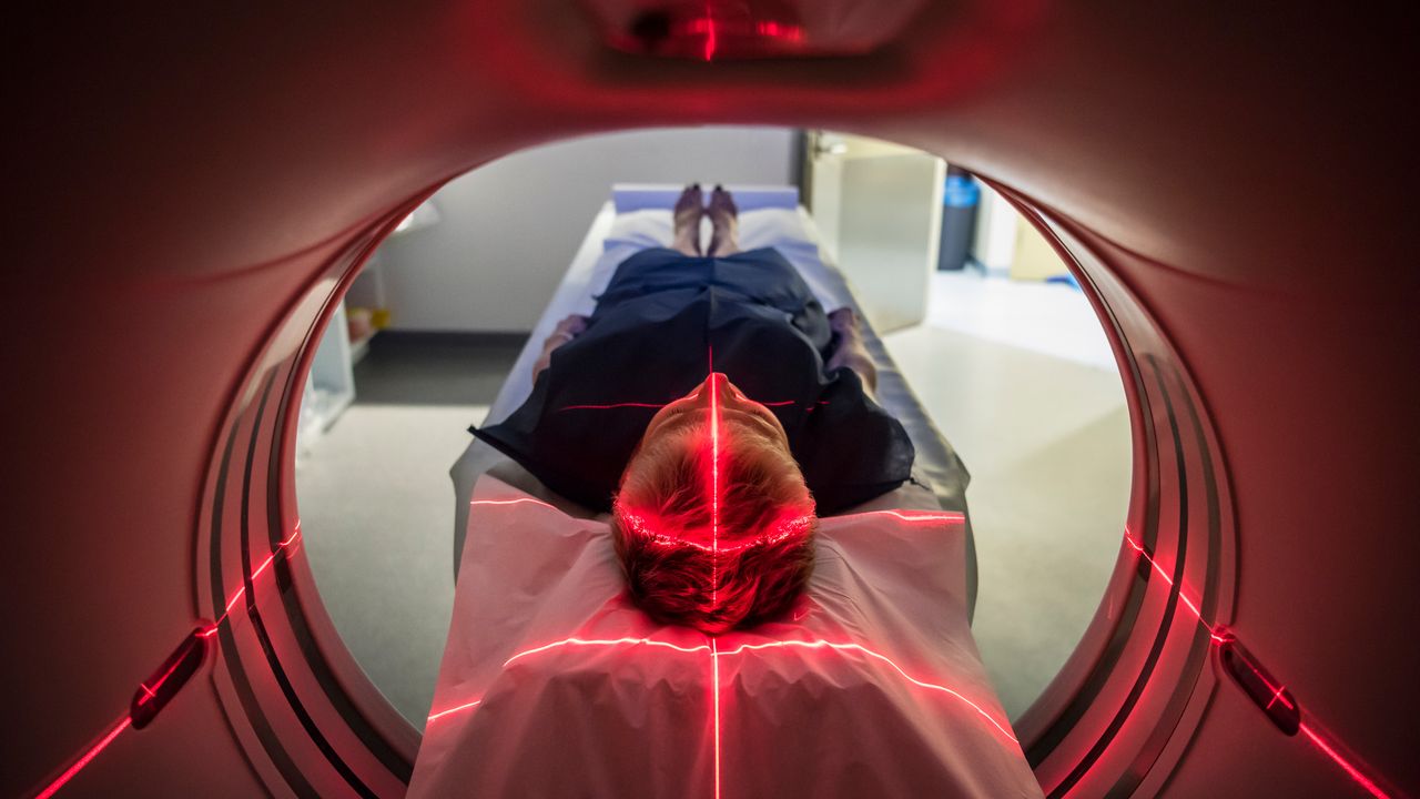 Weight Loss Success Associates With Brain Network Activity