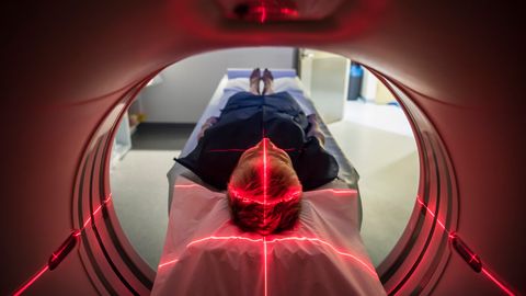 Weight Loss Success Associates With Brain Network Activity