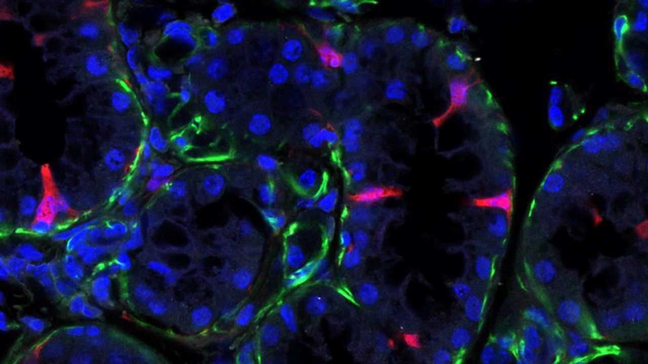 Ionocytes in Salivary Glands