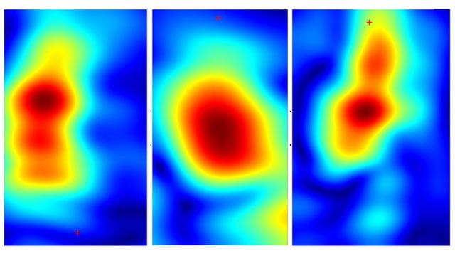 Handheld Device Could Identify Skin Cancers Painlessly | Technology ...