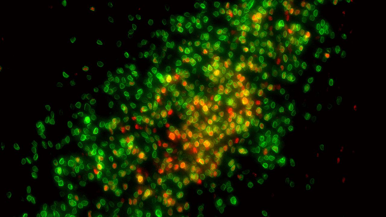 Estrogen Shapes Sex Differences in the Developing Brain
