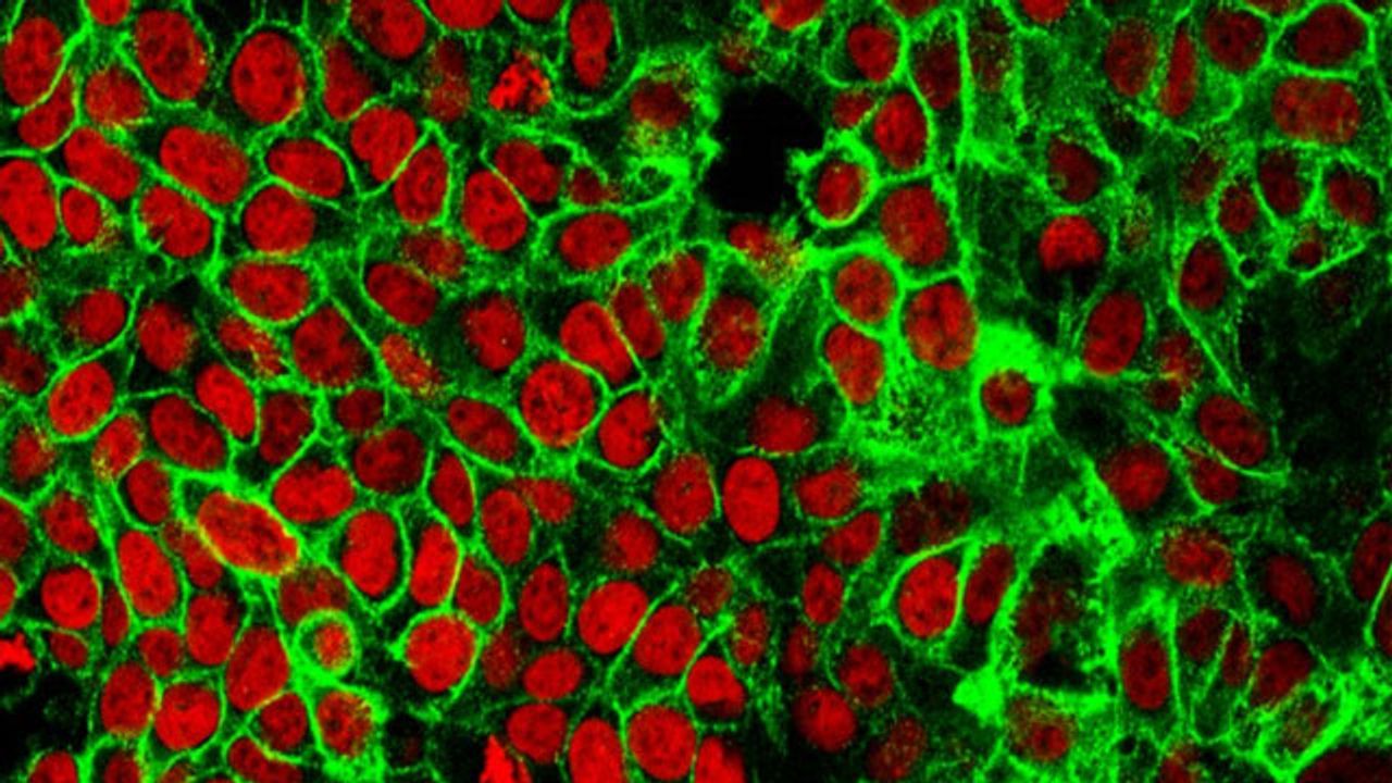 PIP2 Plays a Key Role in Epithelial Cell Adhesion