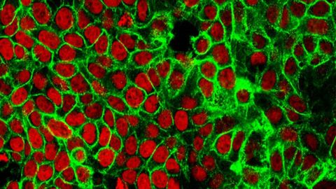 PIP2 Plays a Key Role in Epithelial Cell Adhesion