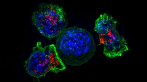 T-Cell Behavior Influences Which Tumors Respond to Immunotherapy