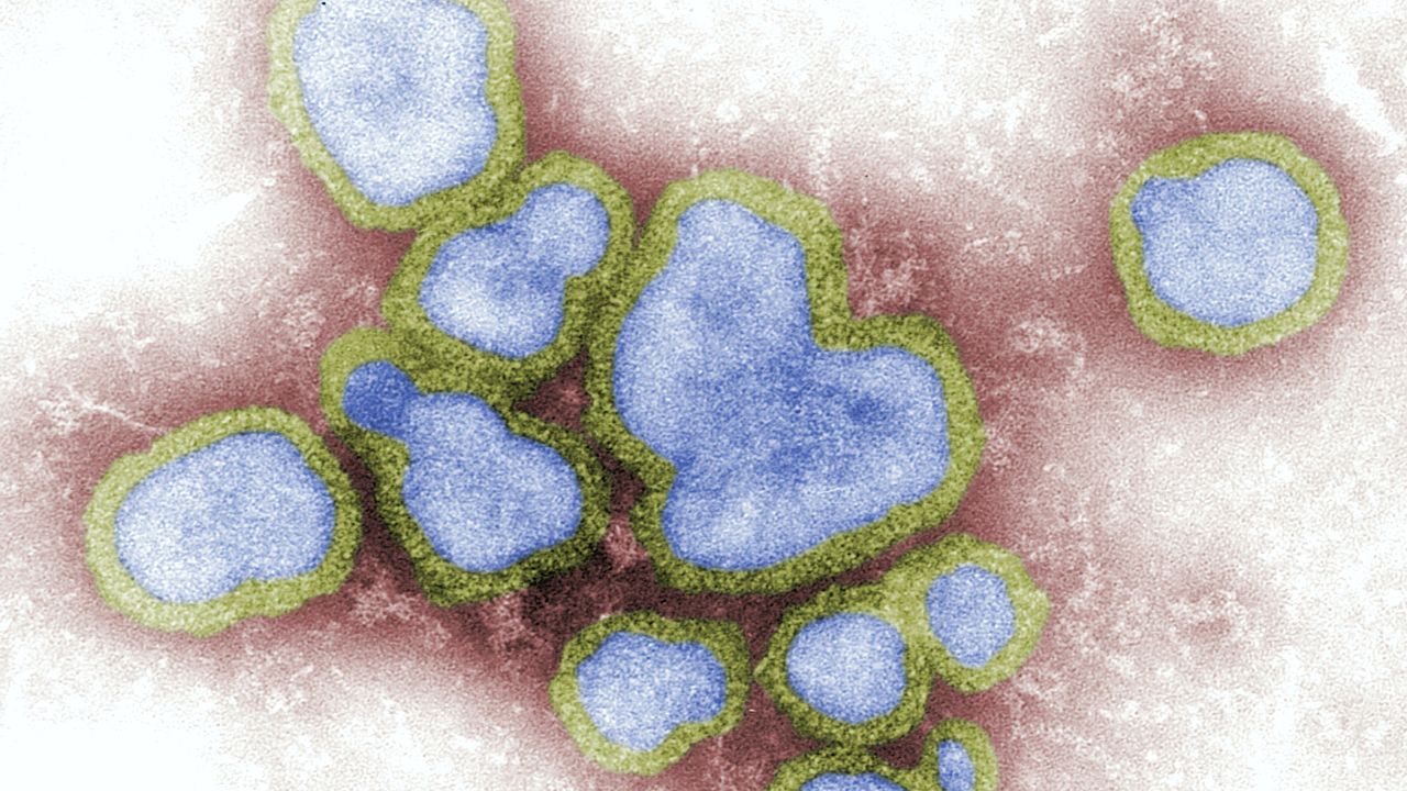 Seasonal Flu May Be Descended From the 1918 Pandemic Strain