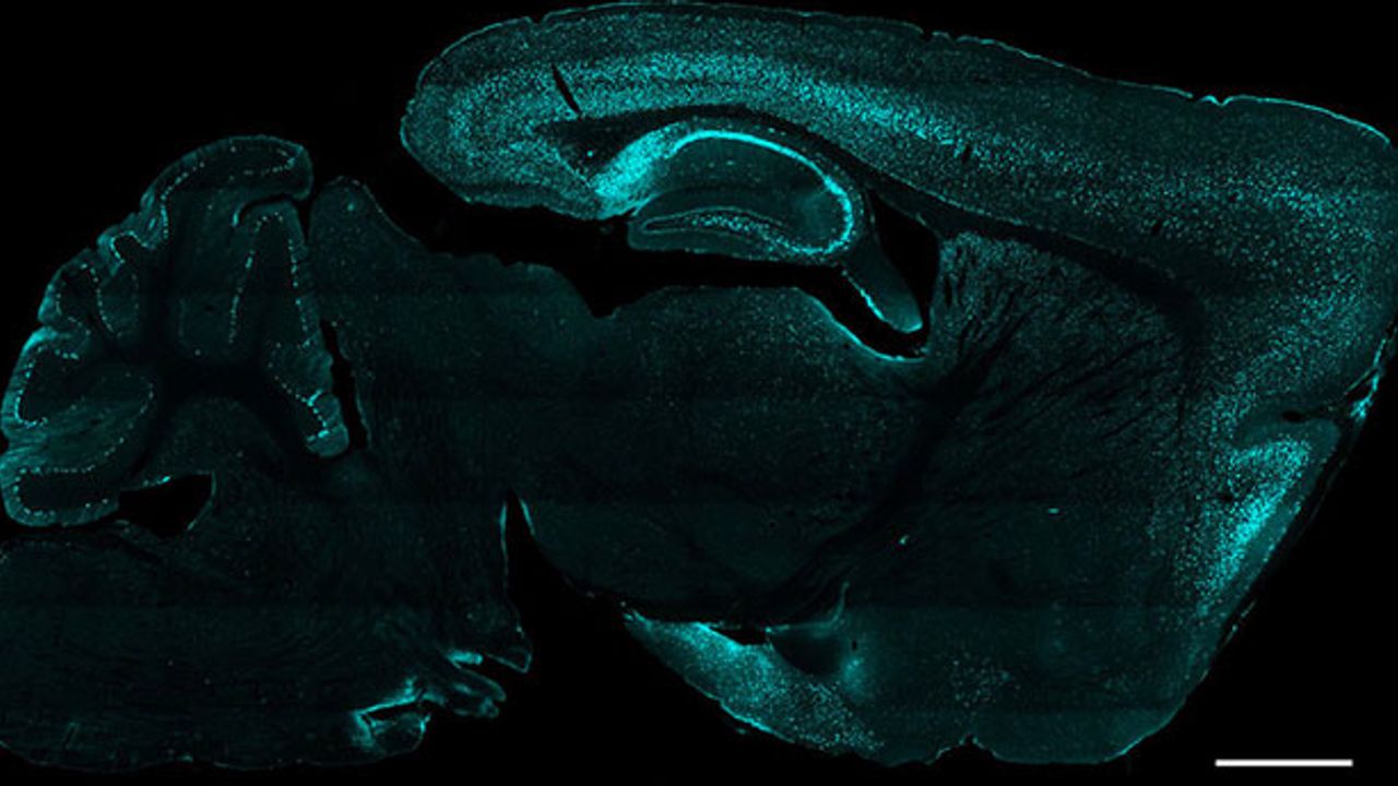 Animal Study Suggests Postnatal Gene Therapy Could Prevent Pitt-Hopkins Syndrome