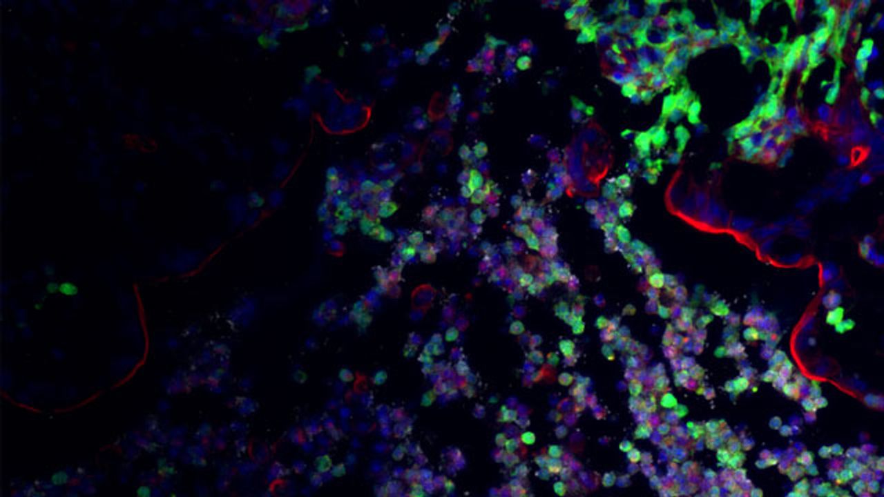 "Good" Gut Microbes Keep Pathogens at Bay by Taking Their Energy Sources