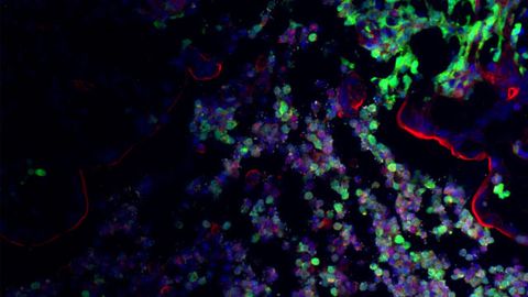 "Good" Gut Microbes Keep Pathogens at Bay by Taking Their Energy Sources