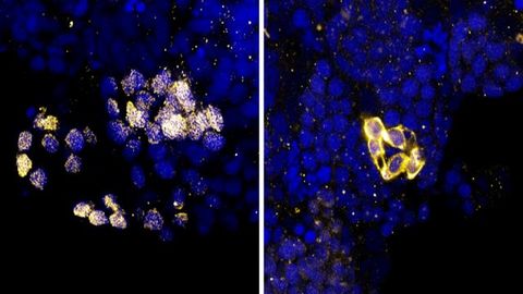 New Animal Model for Studying Crucial Component of Genomic Maintenance New Animal Model for Studying Crucial Component of Genomic Maintenance