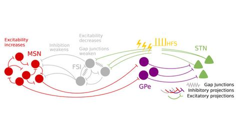 How Electrical Stimulation Restores Balance to the Brain in Parkinson's How Electrical Stimulation Restores Balance to the Brain in Parkinson's