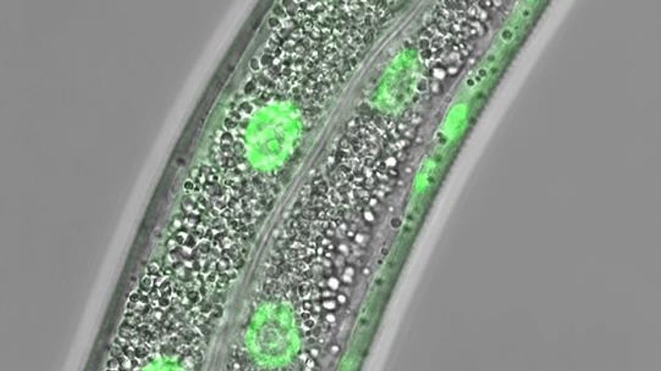 Surveillance Pathway Tells Cells When They Run Low on Lipids content piece image