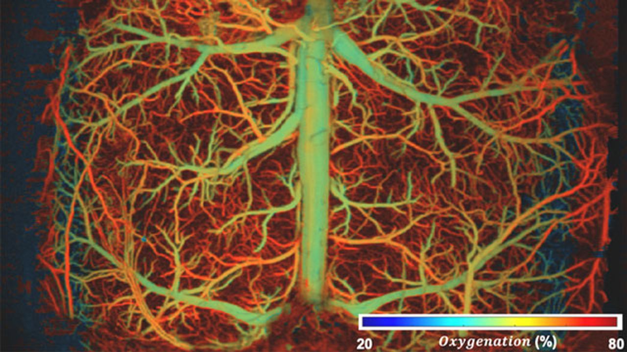 Ultrafast Imaging Reveals Brain Activity in Unprecedented Detail