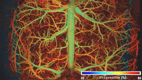Ultrafast Imaging Reveals Brain Activity in Unprecedented Detail Ultrafast Imaging Reveals Brain Activity in Unprecedented Detail