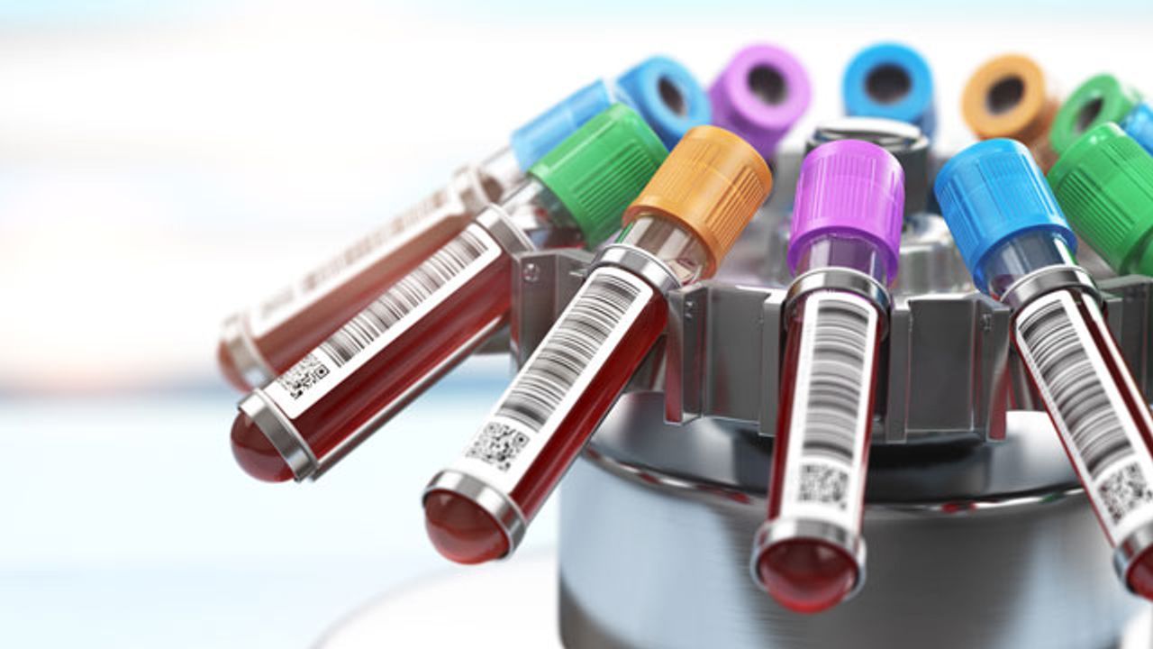 Multiple Myeloma Test Detects More Deadly Forms of the Disease