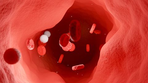 Heart Disease May Be Worsened by Aggressive T Cells Heart Disease May Be Worsened by Aggressive T Cells