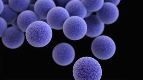 Gene Mutation Predisposes Individuals to Severe Staphylococcus Infections Gene Mutation Predisposes Individuals to Severe Staphylococcus Infections