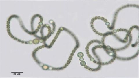 How Freshwater Cyanobacteria Produce a Potent Neurotoxin, Guanitoxin How Freshwater Cyanobacteria Produce a Potent Neurotoxin, Guanitoxin