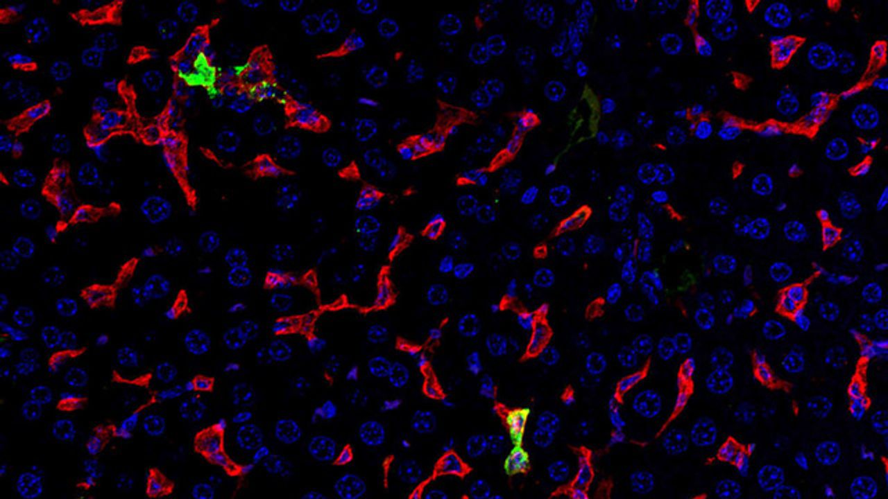 Light Shed on Disease Processes of Crimean-Congo Hemorrhagic Fever
