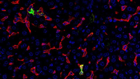 Light Shed on Disease Processes of Crimean-Congo Hemorrhagic Fever Light Shed on Disease Processes of Crimean-Congo Hemorrhagic Fever