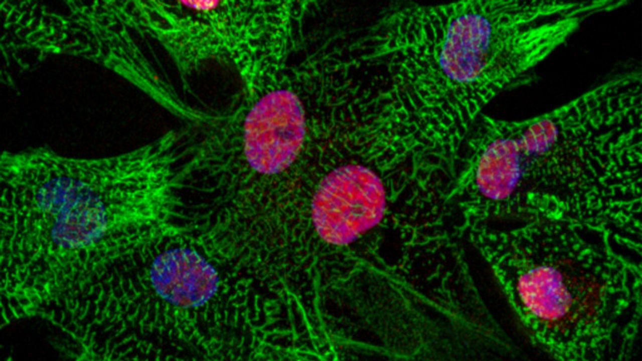 Discovery of a New Gene That Drives Heart Muscle Cell Degradation