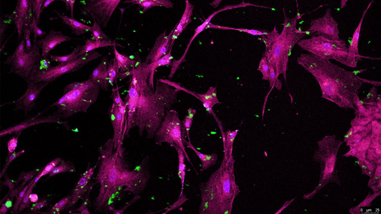 Human Mesenchymal Stem Cells
