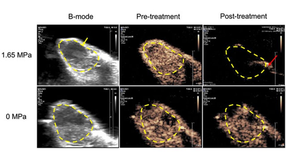 Using Microbubbles for Localized Delivery of Anticancer Drugs content piece image