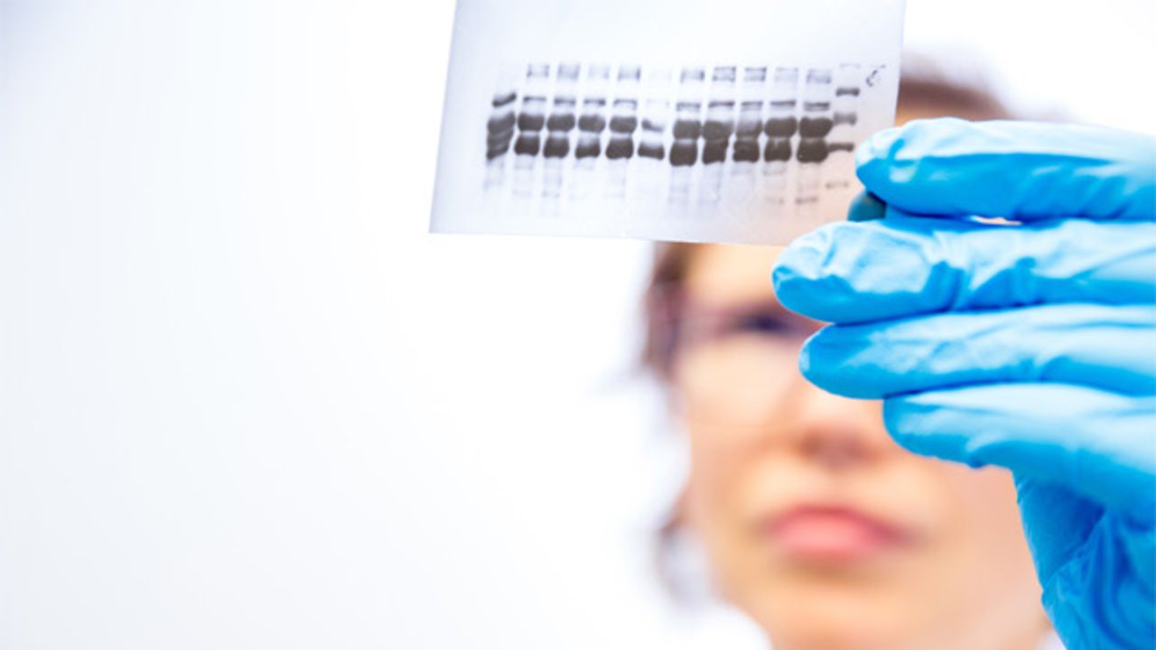 Western Blot Troubleshooting Tips