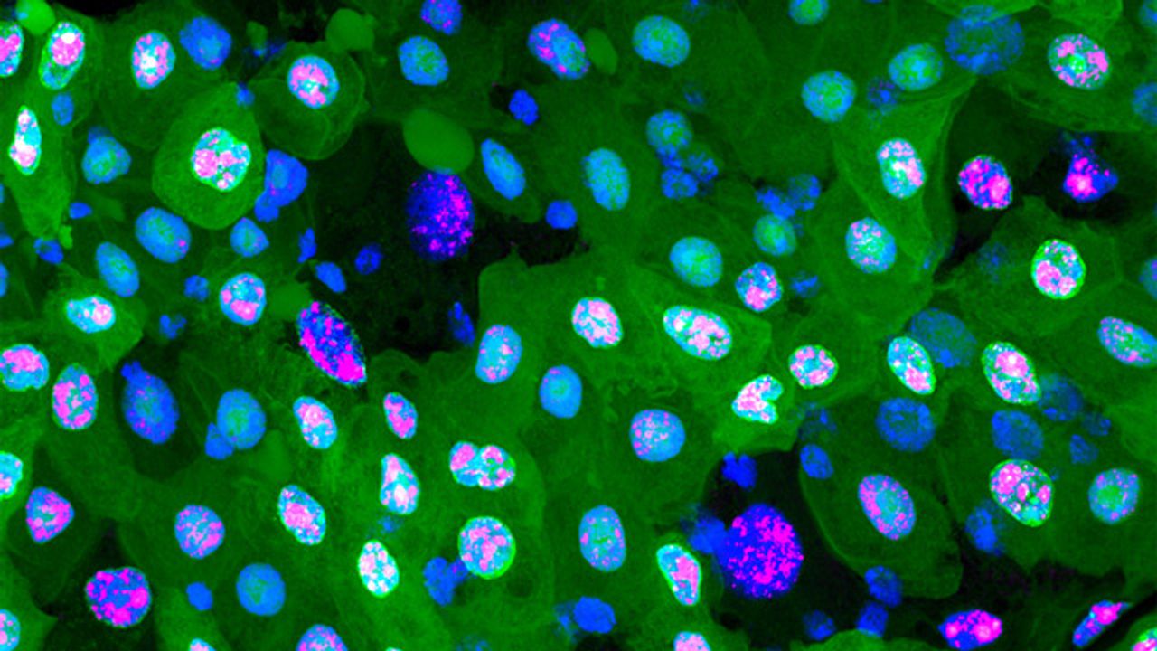 Gut Cells at Different Stages of Erebosis