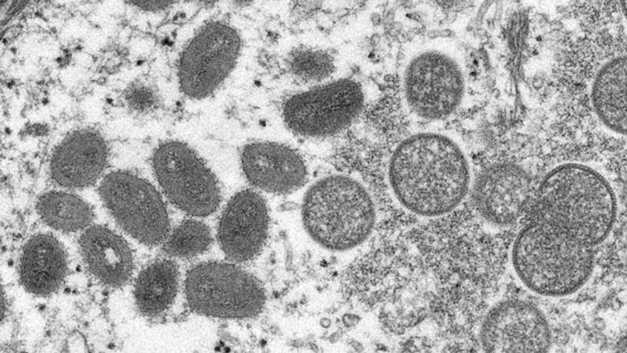 What Is Monkeypox?