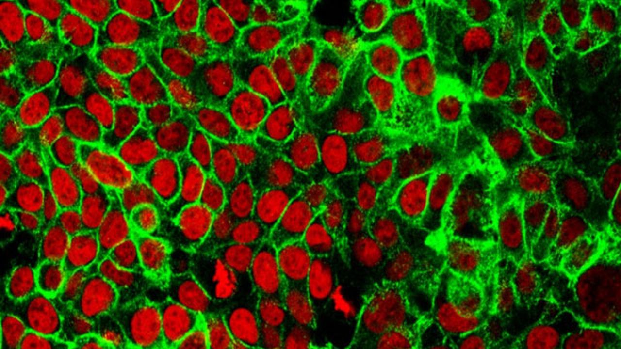 Circulating DNA Shed by Colon Tumors Can Guide Chemotherapy