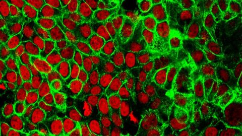 Circulating DNA Shed by Colon Tumors Can Guide Chemotherapy