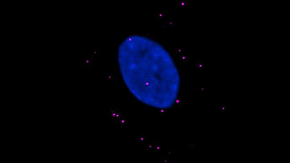 Oil Droplets in Water-Like Process Could Be Key in Regulating Immune Activity content piece image