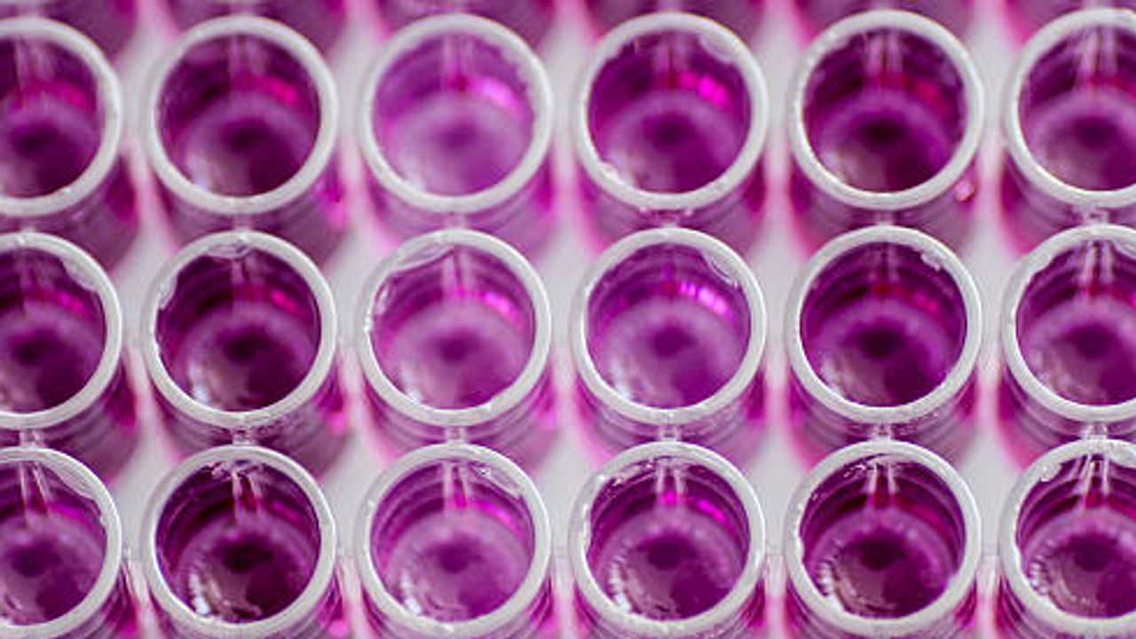 Transfection-Grade Plasmid DNA Purification