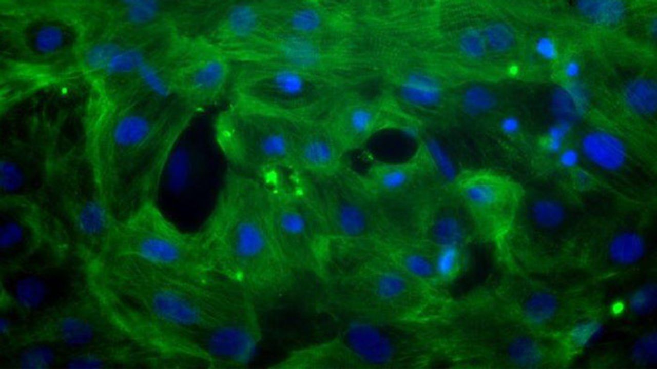 Axol Bioscience Introduces CiPA-Validated Human Stem Cell-Derived Ventricular Cardiomyocytes To Help Improve Drug Discovery
