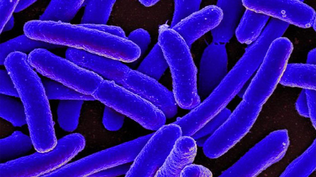 Lab-on-a-Chip Facilitates Bacterial Shape Sorting