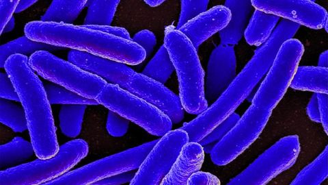 Lab-on-a-Chip Facilitates Bacterial Shape Sorting