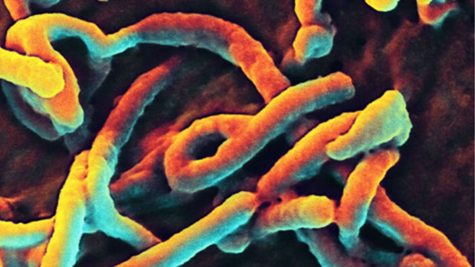 New Tool Could Enable Rapid Ebola Diagnosis content piece image