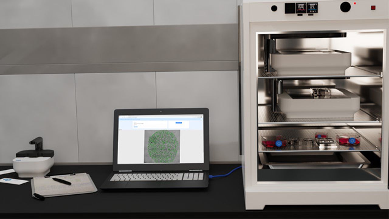CytoSMART Technologies Introduces Machine-Learning Algorithm for Organoid Analysis on the CytoSMART Omni Systems