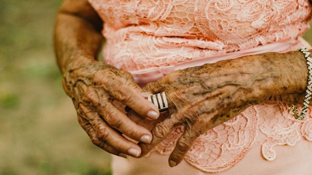 49 Genetic Variants That Increase the Risk of Varicose Veins Identified