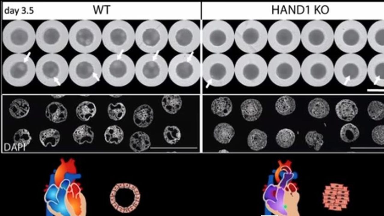 Cardioids Reveal Self-Organizing Principles of Human Cardiogenesis