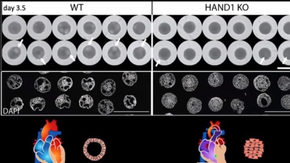 Cardioids Reveal Self-Organizing Principles of Human Cardiogenesis content piece image
